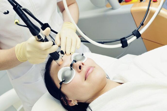 Laser nûjenkirina rûyê