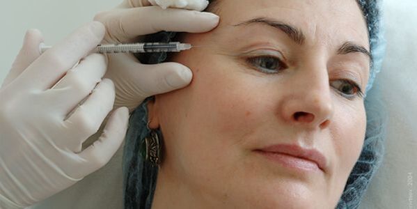 Avantajek girîng a vê rêbazê demek kurt a rehabîlîtasyonê ye