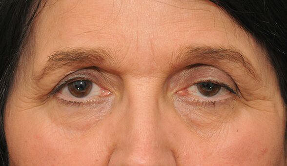 Gravity wrinkles